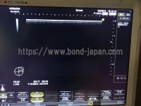 超音波診断装置 | 日立製作所 | Noblusの写真