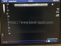 超音波診断装置/カラードプラ | キャノンメディカル株式会社 | Aplio 400の写真