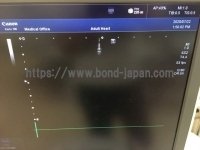 超音波診断装置/カラードプラ | キャノンメディカル株式会社 | TUS-X100 Xario 100の写真