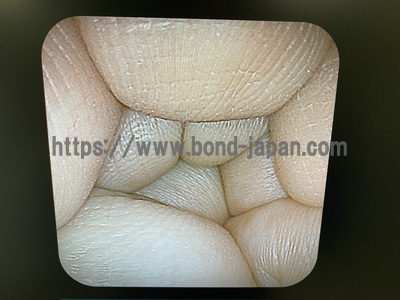 上部消化管経鼻用ビデオスコープ | 富士フイルムメディカル株式会社 | EG-6400Nの写真