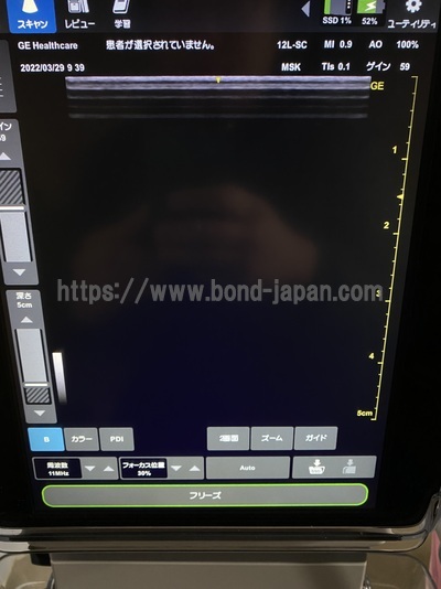 超音波診断装置/カラードプラ | GEヘルスケア・ジャパン株式会社 | Venue 50の写真