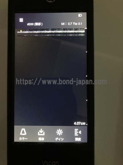 汎用超音波画像診断装置 | GEヘルスケア・ジャパン株式会社 | Vscan Extend R2の写真