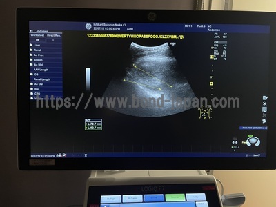 Color Doppler&nbsp;|&nbsp;GE&nbsp;|&nbsp;LOGIQ P7