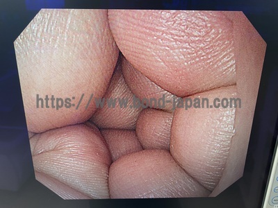 Video Gastroscope&nbsp;|&nbsp;OLYMPUS&nbsp;|&nbsp;GIF-H290