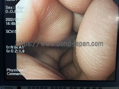 Video Gastroscope&nbsp;|&nbsp;OLYMPUS&nbsp;|&nbsp;GIF-H260