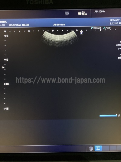 超音波診断装置/カラードプラ | キャノンメディカル株式会社 | Xario 200の写真