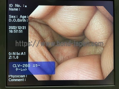 Video Gastroscope&nbsp;|&nbsp;OLYMPUS&nbsp;|&nbsp;GIF-Q260