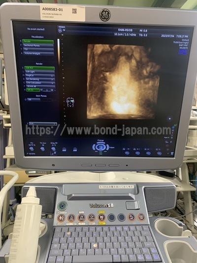 4D Ultrasound | GE | Voluson S8