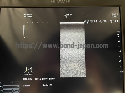 Ultrasound System | HITACHI | ARIETTA 60