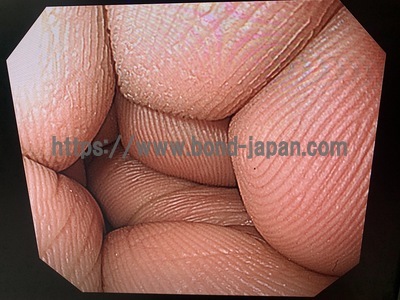 Video Gastroscope&nbsp;|&nbsp;OLYMPUS&nbsp;|&nbsp;GIF-Q240