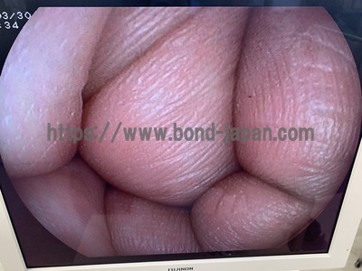 Video Gastroscope&nbsp;|&nbsp;FUJIFILM&nbsp;|&nbsp;EG-3000FP