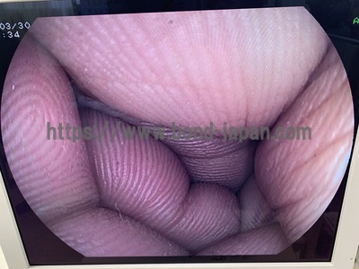 Video Gastroscope&nbsp;|&nbsp;FUJIFILM&nbsp;|&nbsp;EG-250WR5