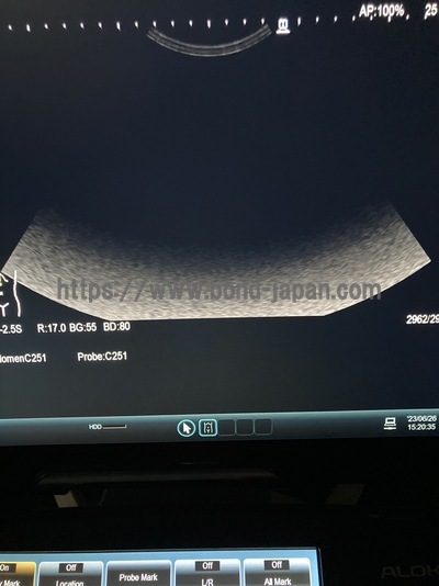 超音波診断装置 | 日立アロカメディカル株式会社 | ARIETTA E70の写真