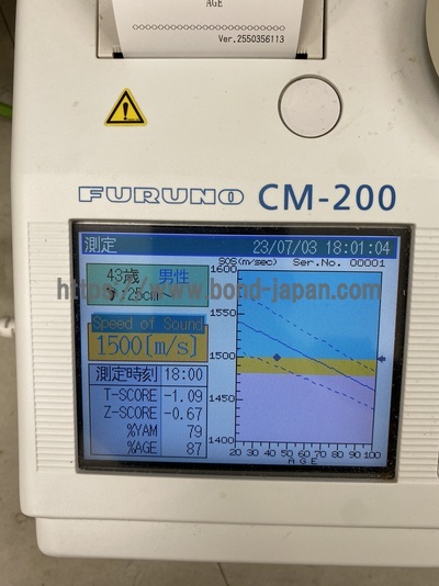 Bone Densitometry | FURUNO | CM-200