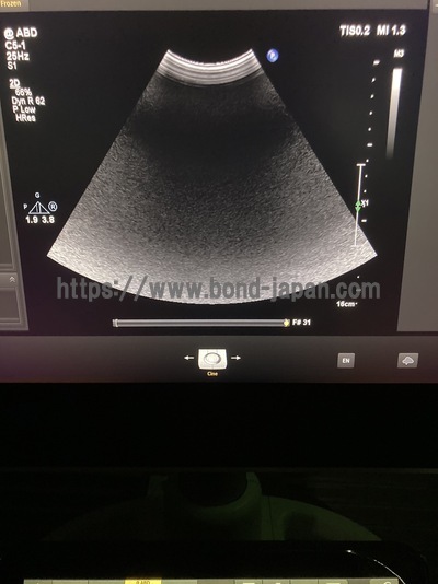 Ultrasound | PHILIPS | EPIQ 7G