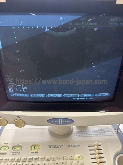 Ultrasound | FUKUDA DENSHI | UF-550XTD