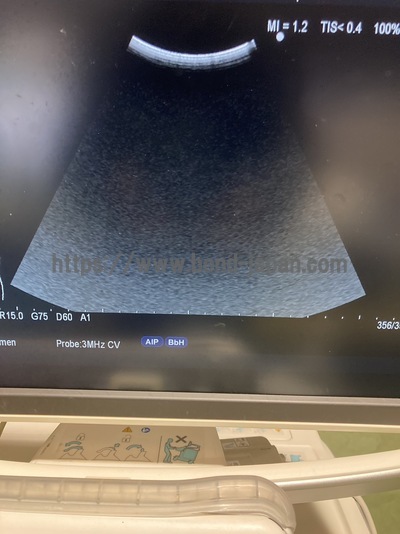 Color Doppler | HITACHI | F75