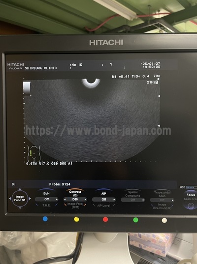 Color Doppler | HITACHI | F37
