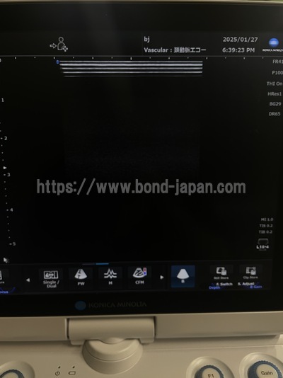Ultrasound | konica | SONIMAGE HS1