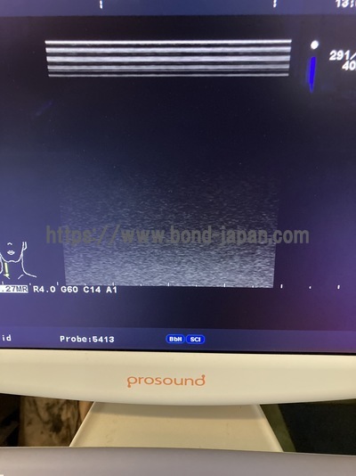 Color Doppler | HITACHI | Prosound α6
