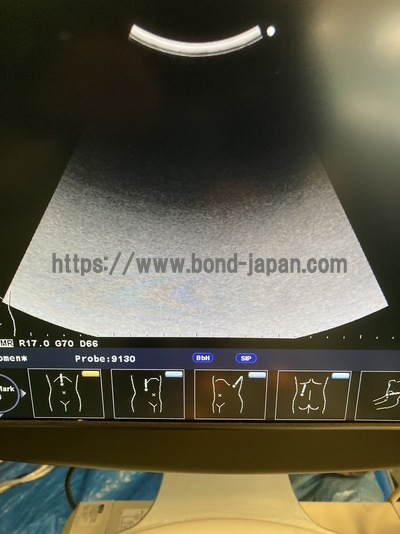 Color Doppler | HITACHI | F37