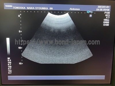 Color Doppler | CANON | SSA-580A Nemio XG