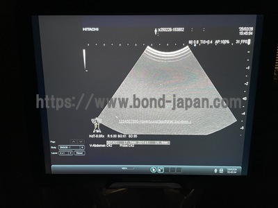 超音波診断装置 | 富士フイルムヘルスケア | ARIETTA 70の写真