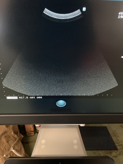 Ultrasound System&nbsp;|&nbsp;FUJIFILM&nbsp;|&nbsp;ARIETTA 50