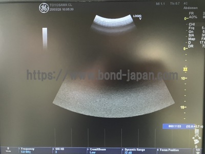 超音波診断装置/カラードプラ | GEヘルスケア・ジャパン株式会社 | LOGIQ V5の写真