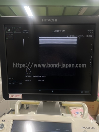 Ultrasound System | HITACHI | ARIETTA 60