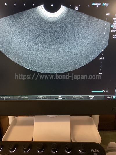 Ultrasound System | CANON | Aplio Go