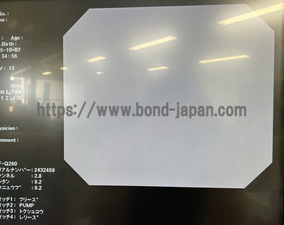 Video Gastroscope | OLYMPUS | GIF-Q260