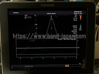 Color Doppler | CANON | SSA-660A Xario