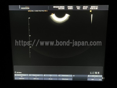 Ultrasound System | Samsung Medison | SONOACE R7