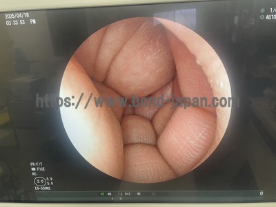 Video Gastroscope | FUJIFILM | EG-530N2
