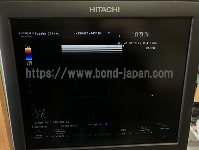 Color Doppler | HITACHI | F37
