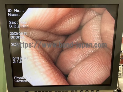 Video Gastroscope | OLYMPUS | GIF-H260
