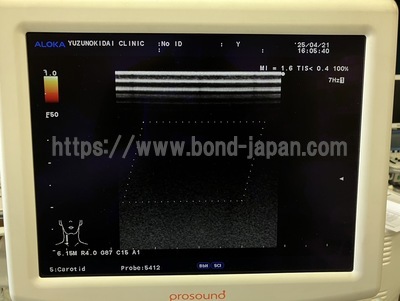 Ultrasound System | HITACHI | Prosound α7