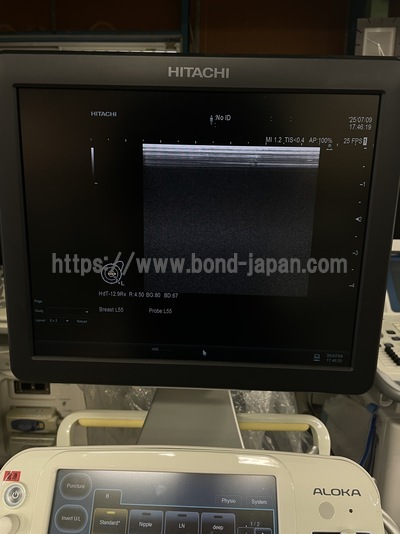 超音波診断装置 | 日立製作所 | ARIETTA 60の写真