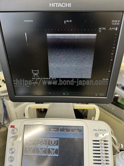 超音波診断装置 | 日立製作所 | ARIETTA 60の写真