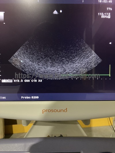 Color Doppler | HITACHI | Prosound α6