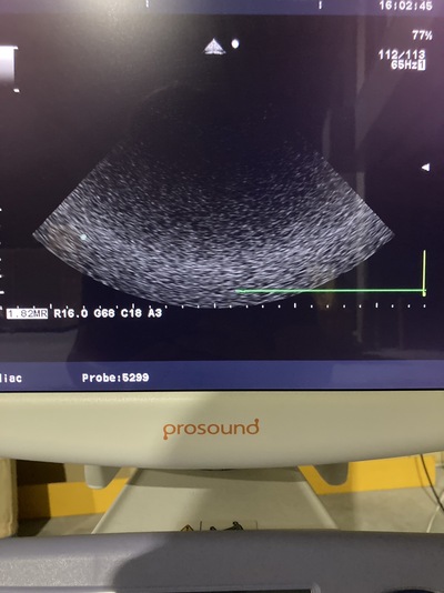 Color Doppler&nbsp;|&nbsp;HITACHI&nbsp;|&nbsp;Prosound α6