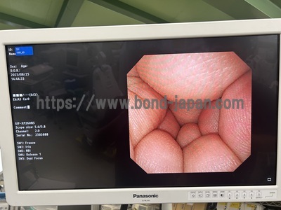Video Gastroscope | OLYMPUS | GIF-XP260NS
