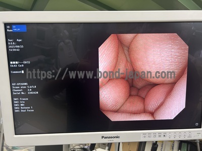 Video Gastroscope | OLYMPUS | GIF-XP260NS