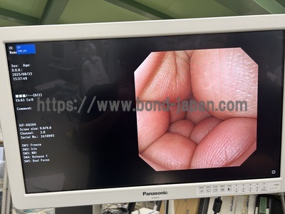 Video Gastroscope | OLYMPUS | GIF-XQ260