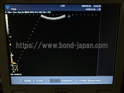  | FUKUDA DENSHI | UF-760AG+