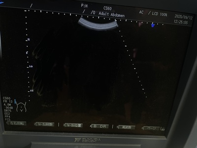 Ultrasound&nbsp;|&nbsp;FUKUDA DENSHI&nbsp;|&nbsp;UF-450AX