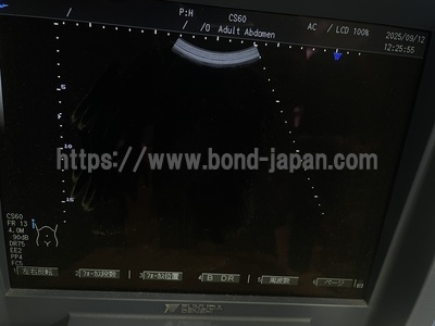 Ultrasound | FUKUDA DENSHI | UF-450AX