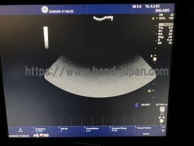 Color Doppler | GE | LOGIQ V5 Expert