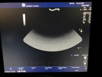 Color Doppler&nbsp;|&nbsp;GE&nbsp;|&nbsp;LOGIQ V5 Expert